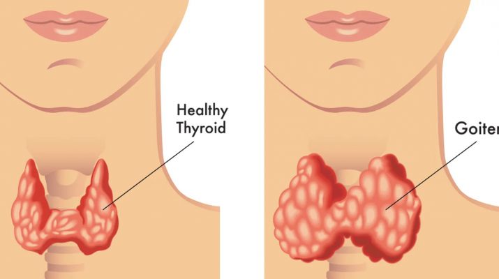 5-Things-You-Need-To-Know-About-Your-Thyroid