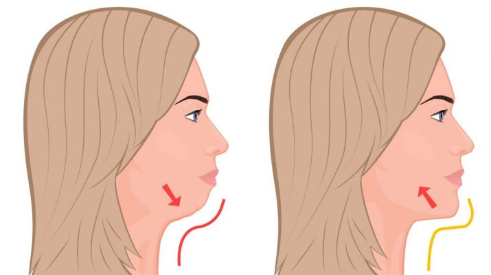 7-Exercises-That-Remove-Double-Chin