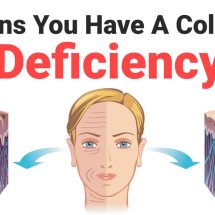 8 Signs You Have A Collagen Deficiency