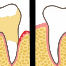 Dentists Explain 7 Habits That Ruin Your Teeth and Gums (And How to Fix It)