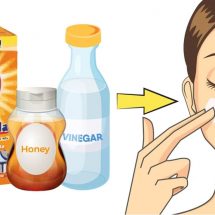 Honey, Baking Soda & Apple Cider Vinegar Mask For Acne & Radiant Skin