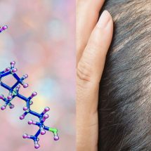 Researchers Reveal The Connection Between Vitamin D Deficiency And Hair Loss