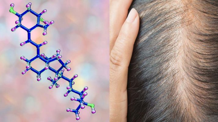 Researchers-Reveal-The-Connection-Between-Vitamin-D-Deficiency-And-Hair-Loss