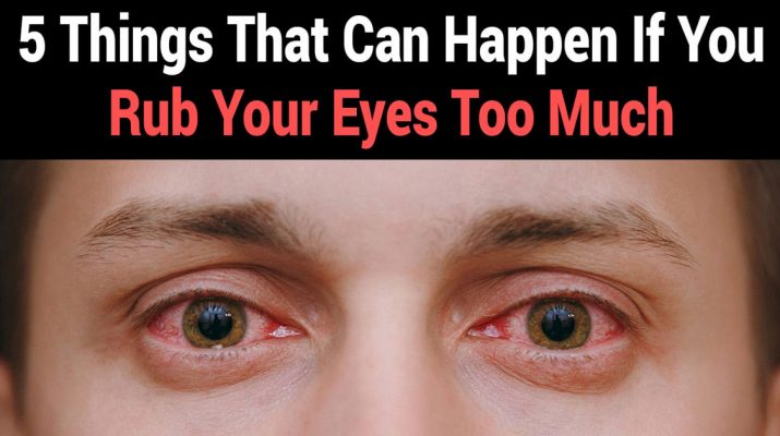 Scientists-Explain-5-Things-That-Can-Happen-If-You-Rub-Your-Eyes-Too-Much