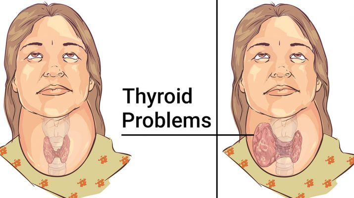 This-60-Second-Test-Will-Tell-You-If-Your-Thyroid-Is-Working-Properly