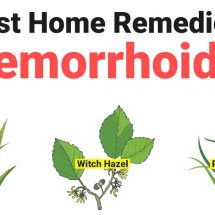 10 Best Home Remedies For Hemorrhoids