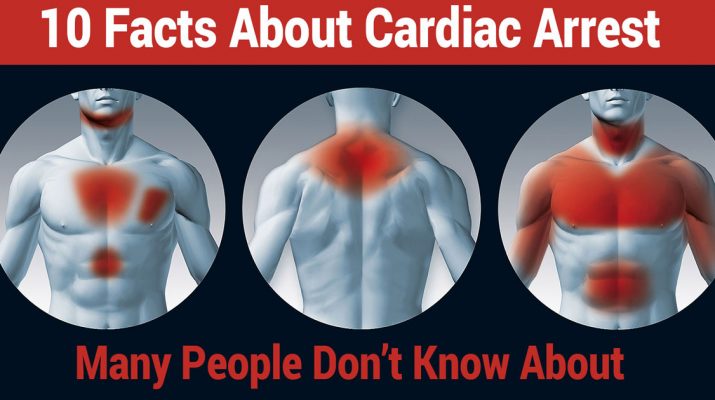 10-Facts-About-Cardiac-Arrest-Many-People-Don’t-Know-About