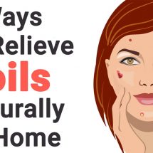 7 Ways to Relieve Boils Naturally At Home