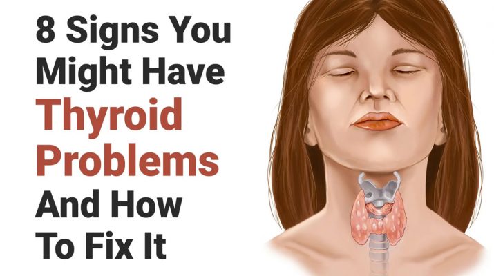 8-Signs-You-Might-Have-Thyroid-Problems-And-How-To-Fix-It