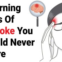 8 Warning Signs Of A Stroke You Should Never Ignore