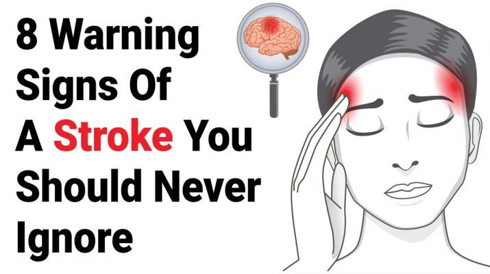 8 Warning Signs Of A Stroke You Should Never Ignore