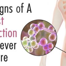 9 Signs of A Yeast Infection to Never Ignore