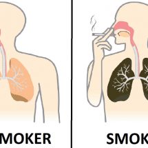 Nurse Explains What Smoking Every Day Does To Your Lungs