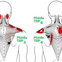 Try These 15 Stretches to Relieve a Stiff Neck, Tight Shoulders And Upper Back Pain!