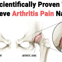 10 Scientifically Proven Ways to Relieve Arthritis Pain Naturally