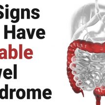 11 Signs You Have Irritable Bowel Syndrome