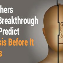 Researchers Reveal Breakthrough Way to Predict Psychosis Before It Happens