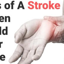 Signs of A Stroke Women Should Never Ignore