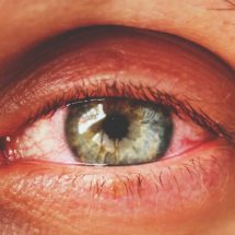 5 Signs You Are Getting Pink Eye