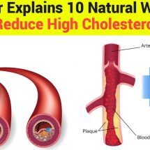 Doctor Explains 10 Natural Ways to Reduce High Cholesterol