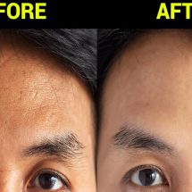 How Japanese “Korugi Massage” Will Remove Years From Your Face