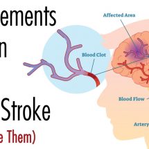 5 Supplements That Can Help Prevent a Brain Stroke