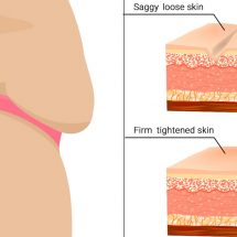 11 Easy Ways to Tighten Skin Naturally