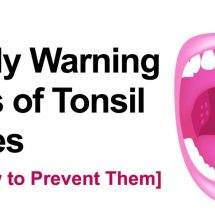 5 Early Warning Signs of Tonsil Stones (And How to Prevent Them)