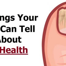 6 Things Your Nails Can Tell You About Your Health