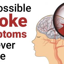 Prevent A Stroke: 15 Stroke Symptoms to Never Ignore
