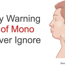 7 Early Warning Signs of Mono to Never Ignore