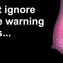 5 Early Warning Signs of Breast Cancer Most Women Ignore