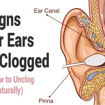 5 Signs Your Ears Are Clogged (And How to Unclog Them Naturally)