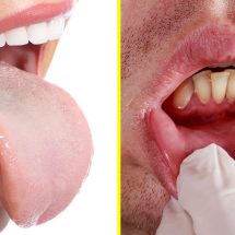 5 Signs to Never Ignore From Your Mouth