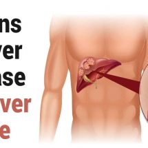 8 Signs of Liver Disease to Never Ignore