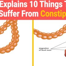 Doctor Explains 10 Things To Try If You Suffer From Constipation