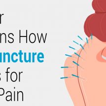 Doctor Explains How Acupuncture Works for Back Pain
