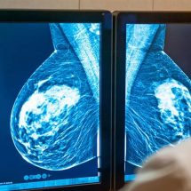 Doctors Explain Why A Mammogram Is the Best Way to Detect Breast Cancer