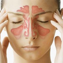 Home remedies for nasal congestion