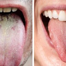 Researchers Explain What The Color of Your Tongue Says About Your Health
