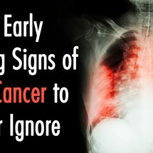 10 Early Warning Signs of Lung Cancer to Never Ignore