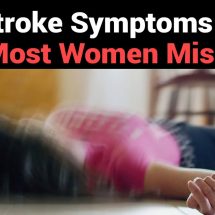 10 Stroke Symptoms That Most Women Miss