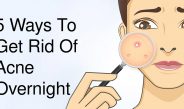 5 Ways To Get Rid Of Acne Overnight