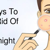 5 Ways To Get Rid Of Acne Overnight
