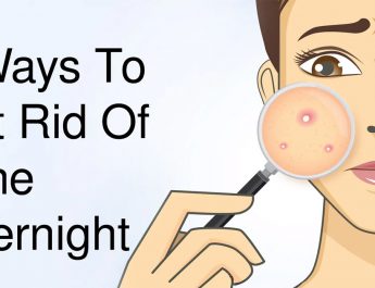 5 Ways To Get Rid Of Acne Overnight