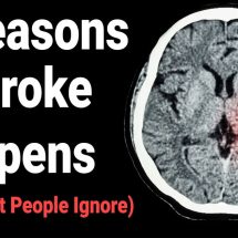 8 Reasons A Stroke Happens (That Most People Ignore)