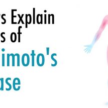 Doctors Explain 6 Signs of Hashimoto’s Disease